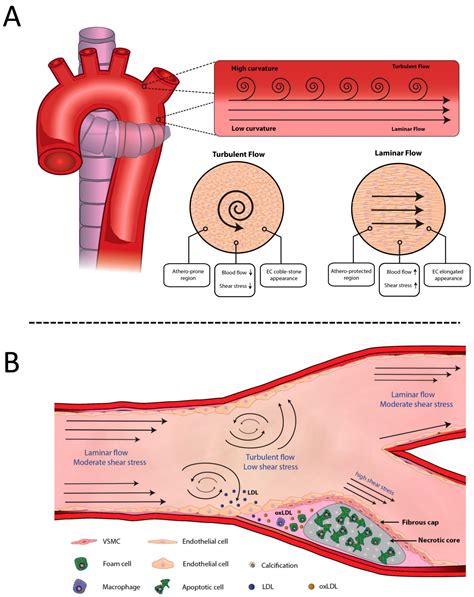 atherosclerotic aorta in tagalog|Translate atherosclerotic aorta in Tagalog with examples.